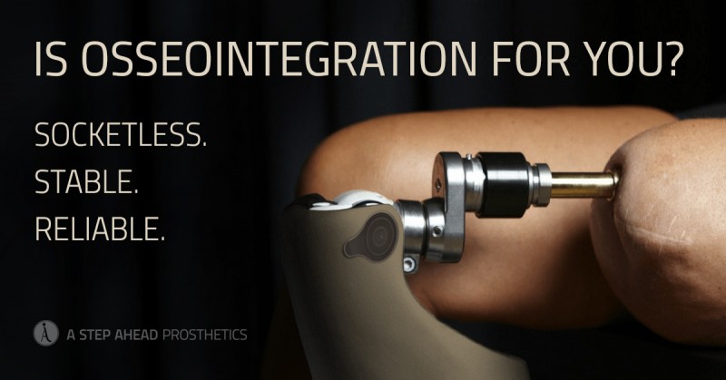 Osseointegration: A Promising Alternative For Amputees - A Step Ahead ...