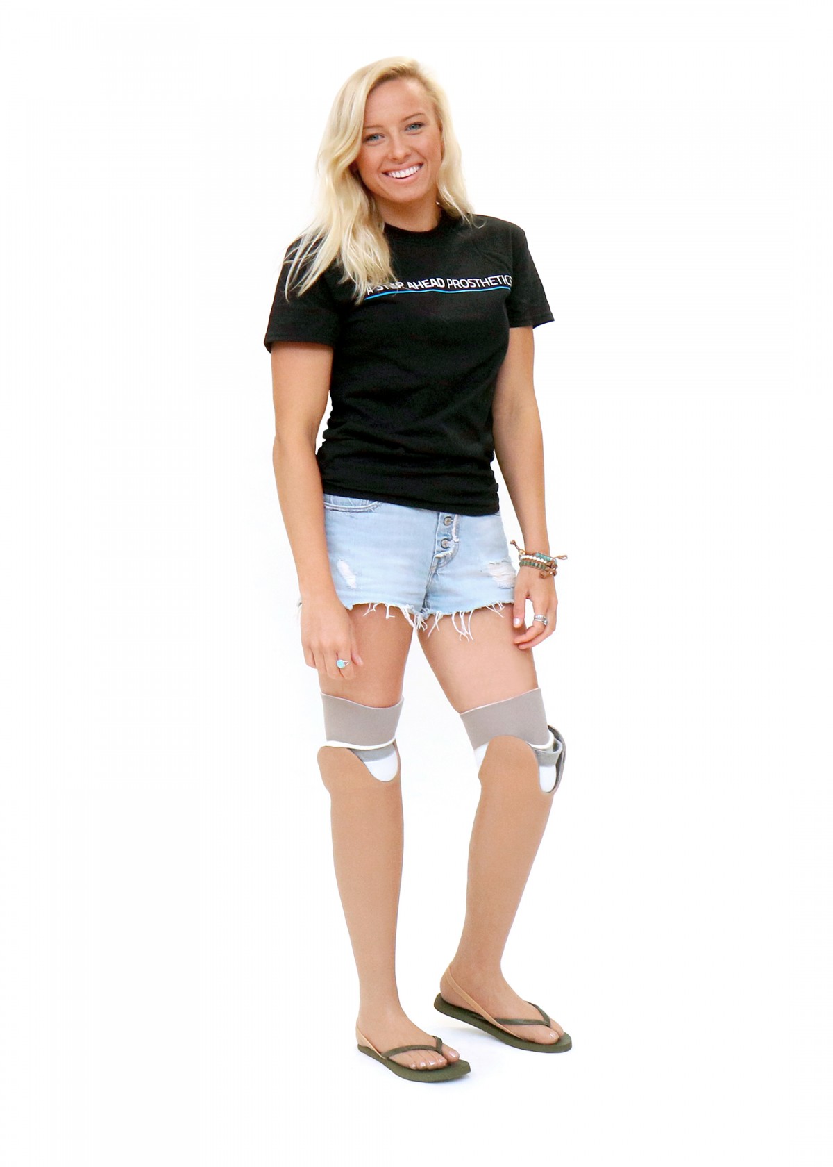 Jessica - A Step Ahead Prosthetics