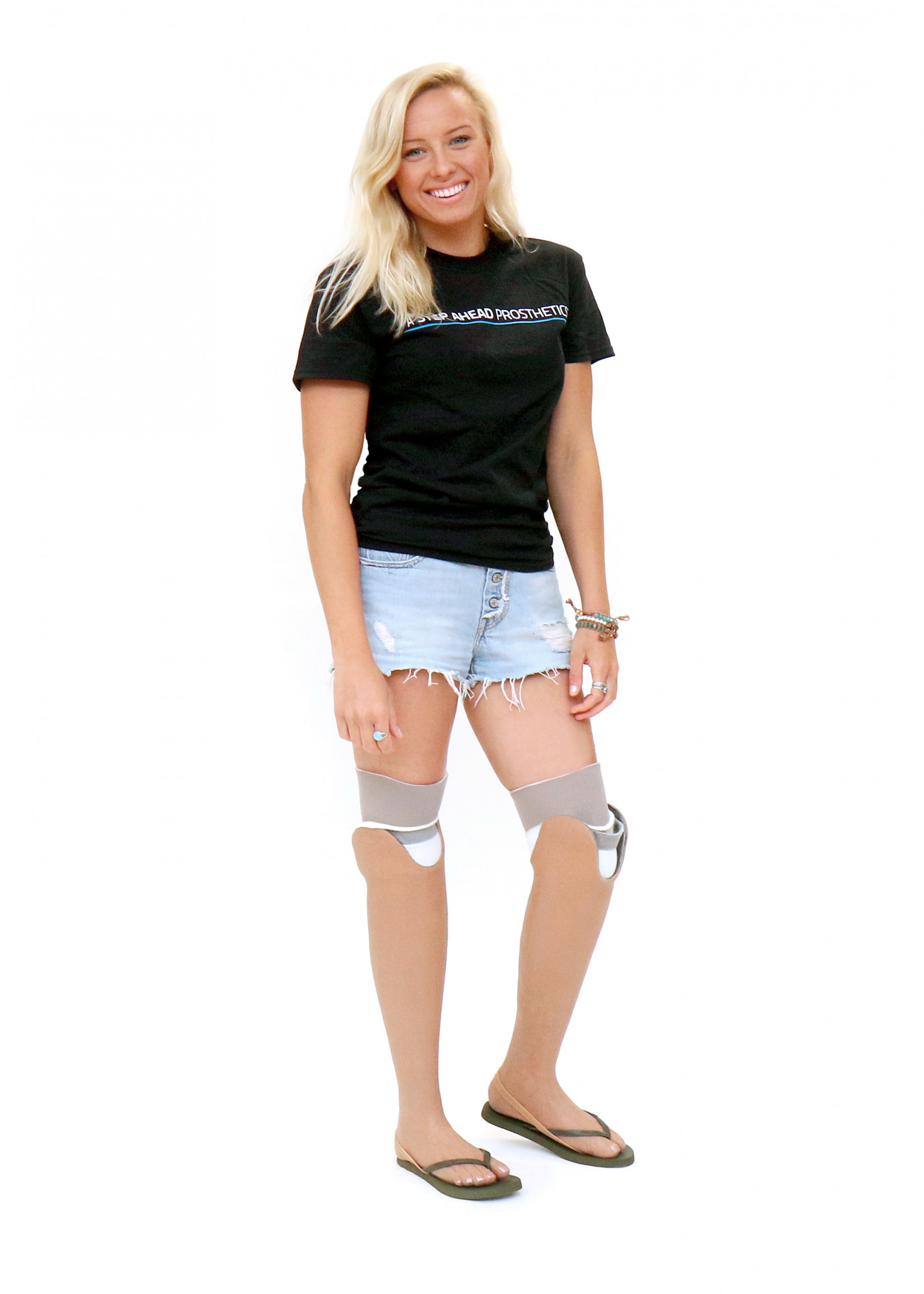 Jessica - A Step Ahead Prosthetics