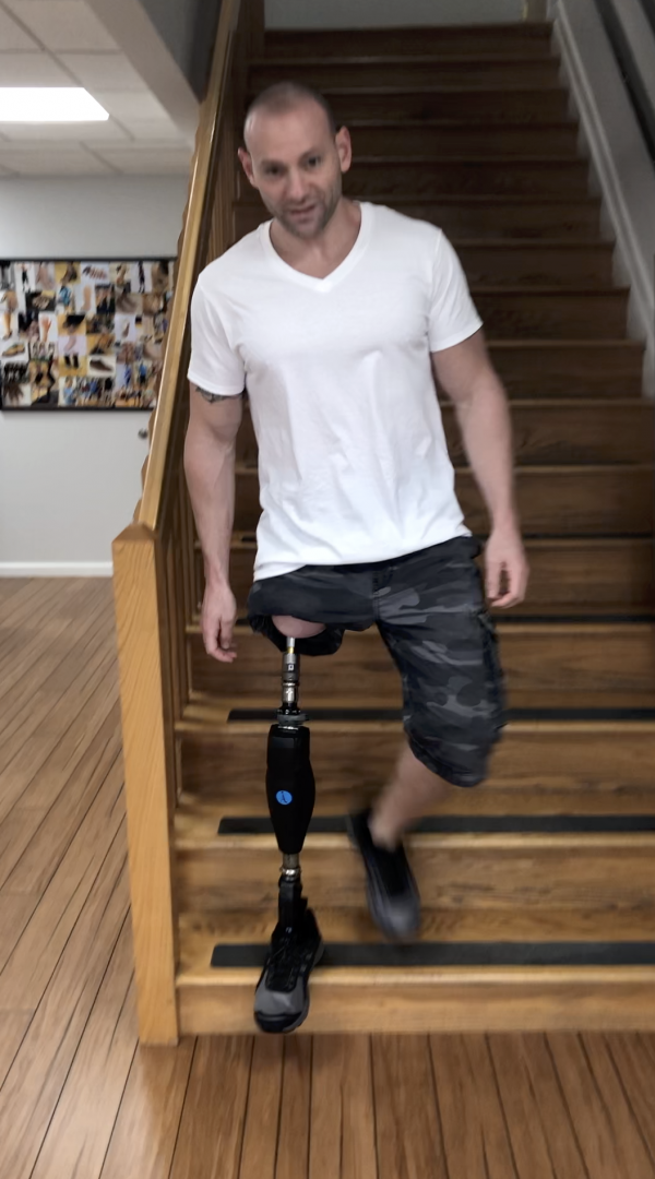 Osseointegration-stairs-ak - A Step Ahead Prosthetics