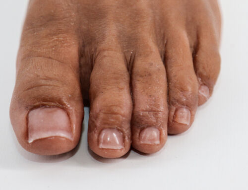 Looking for Realistic Silicone Prosthetics?